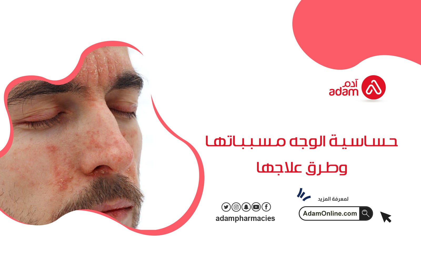 حساسية الوجه مسبباتها وطرق علاجها